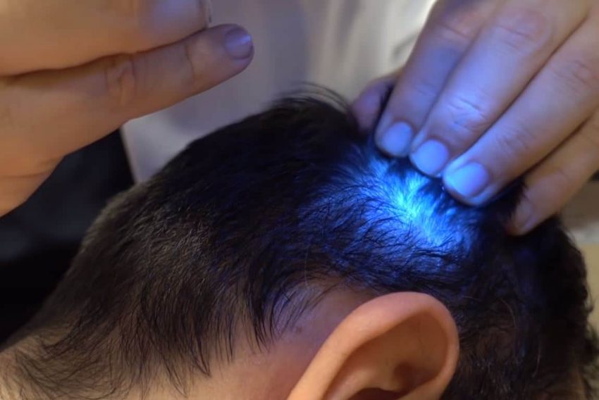 FX16 Men Hair Solution Saç Çıkarır mı? Nasıl Kullanılır? Kullanıcı Yorumları ve Yan Etkileri